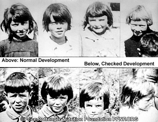 Name:  wide and narrow palates_gaelic_children.jpg
Views: 31796
Size:  50.3 KB